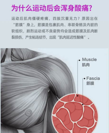 筋膜枪，是放松神器还是健康隐患？揭秘其真实效用与四大潜在风险